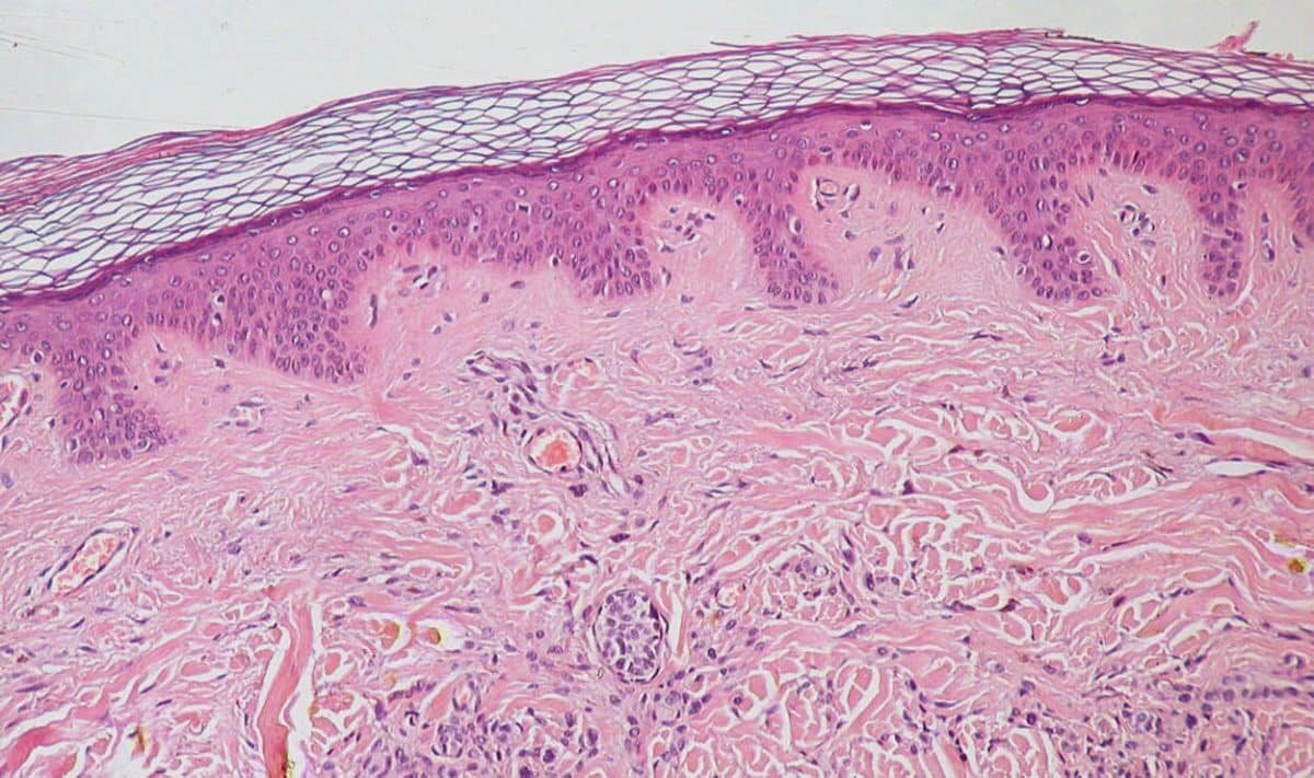    Эпидермис и дерма кожи человека © Kilbad, wikipedia