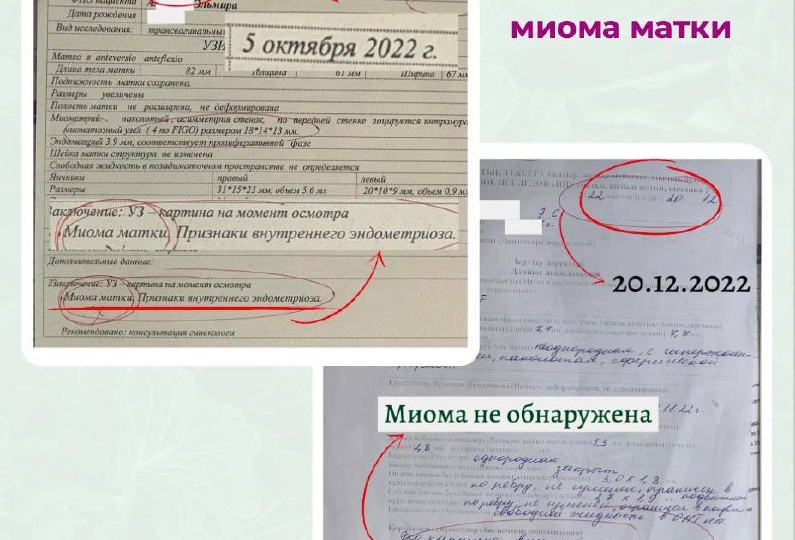 Печень и женское здоровье: где связь