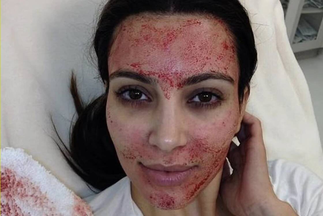 Источник: Instagram