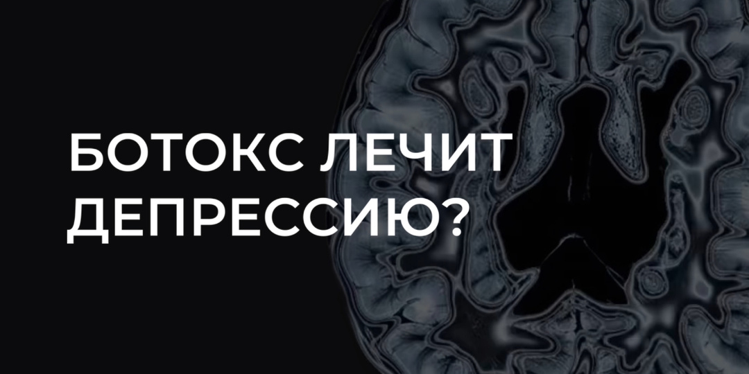«Укол от морщин» или от грусти? Как ботулинотерапия помогает при депрессии?