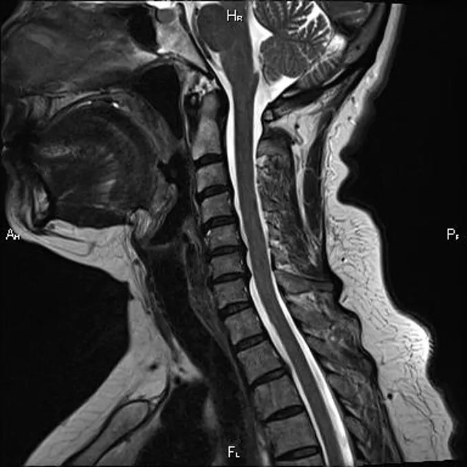 МРТ шейного отдела. https://mrtpetrograd.ru/webp/original/assets/img/gallery/license/2730935e82a33cb6d17aeafd1ca5ed47.jpg.webp
