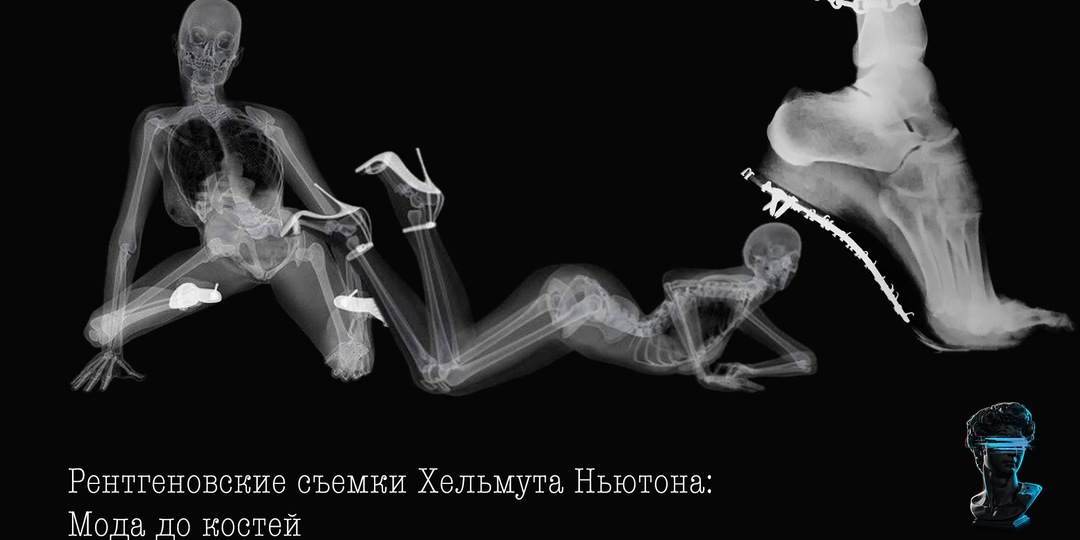 Рентгеновские съемки Хельмута Ньютона: Мода до костей