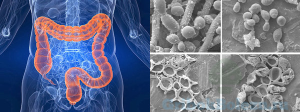 Чем питаются паразиты и грибы в нашем организме: что скрывается внутри нас