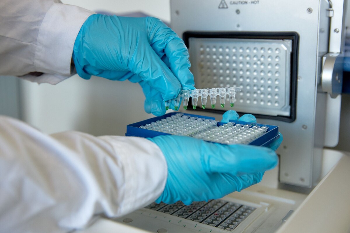 Как проводится диагностика болезни под названием «Крейтцфельда-Якоба»