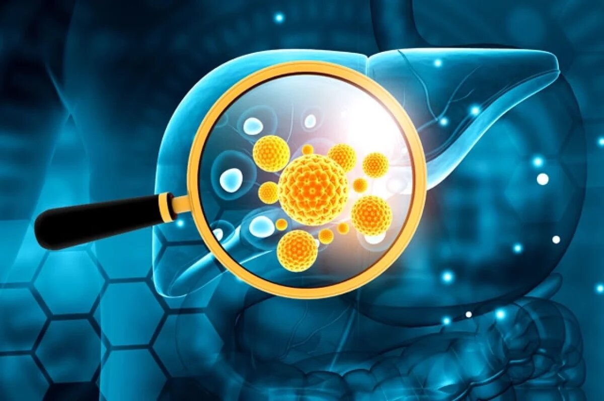    Врач Черемушкин сказал, как онкобольные Камчатки могли заразиться гепатитом