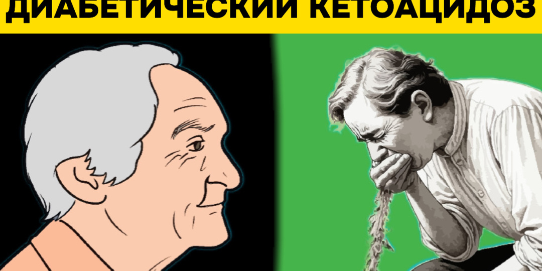 Рейтинг угроз при диабете: пять состояний, требующих немедленных действий