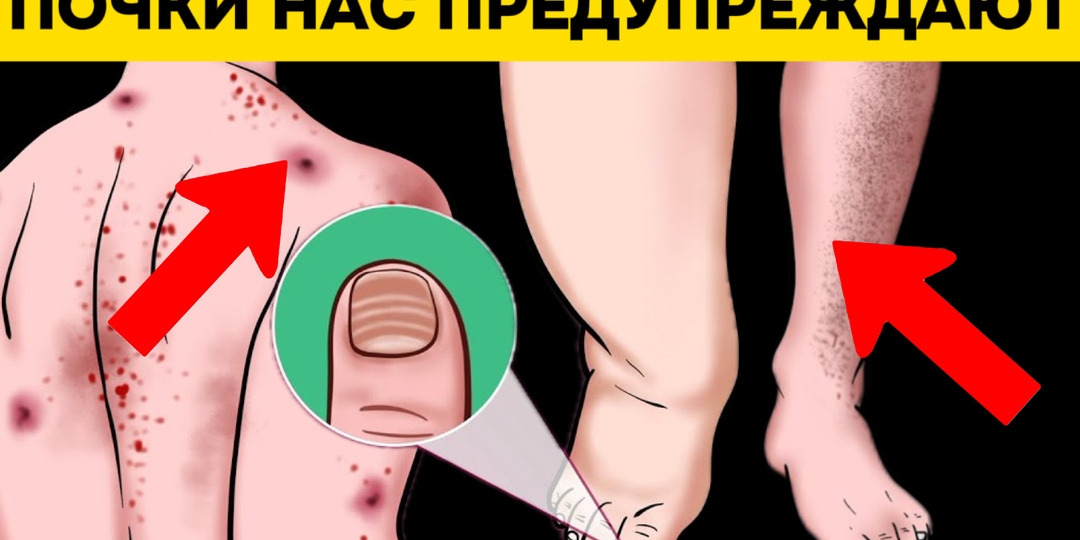 Как болят почки: врач объясняет отличие от боли в спине