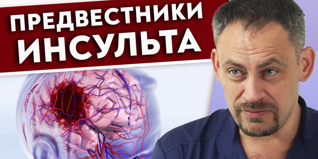 Первые признаки инсульта. Как предотвратить инсульт?