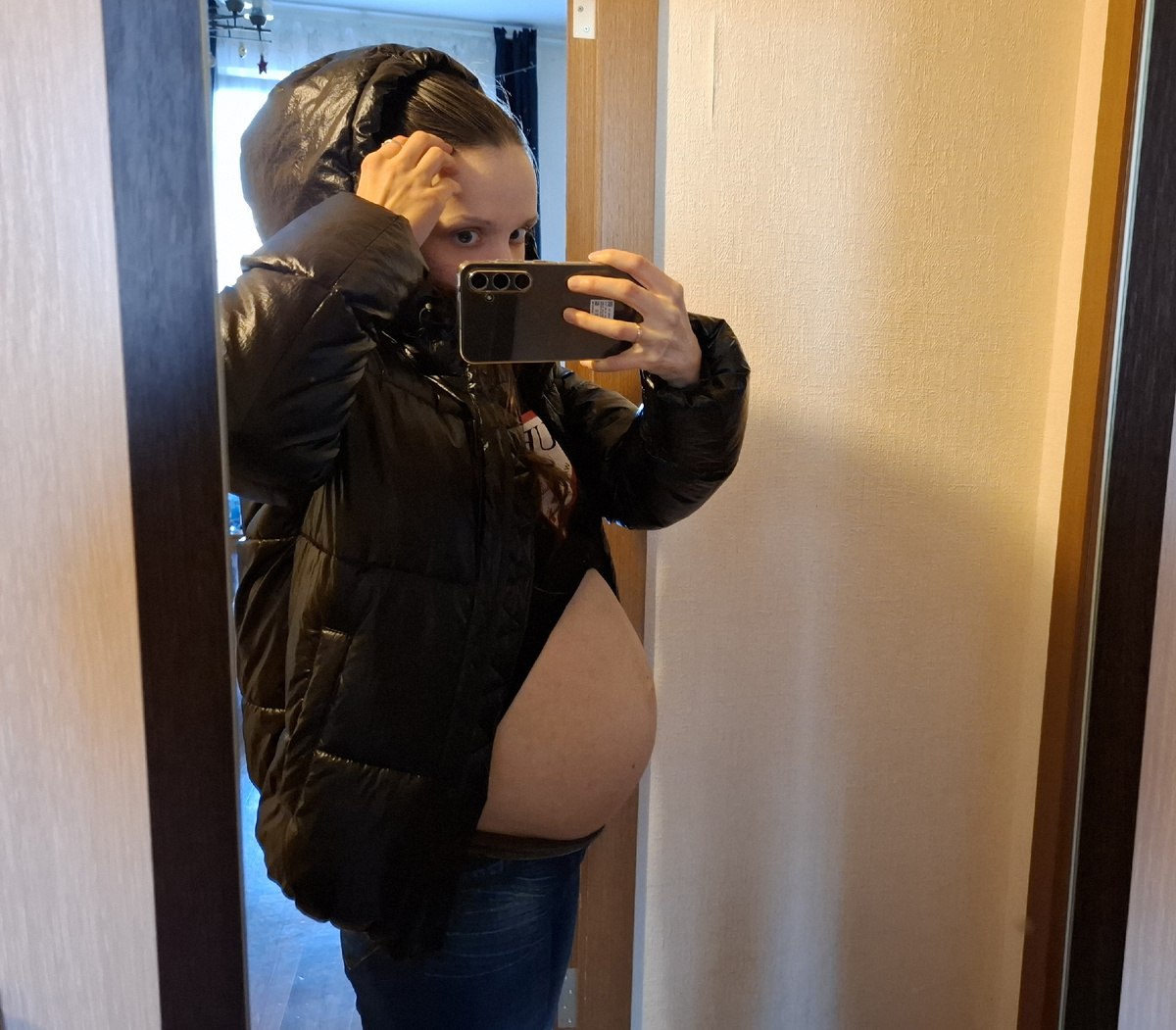 Асцит за пару дней до госпитализации