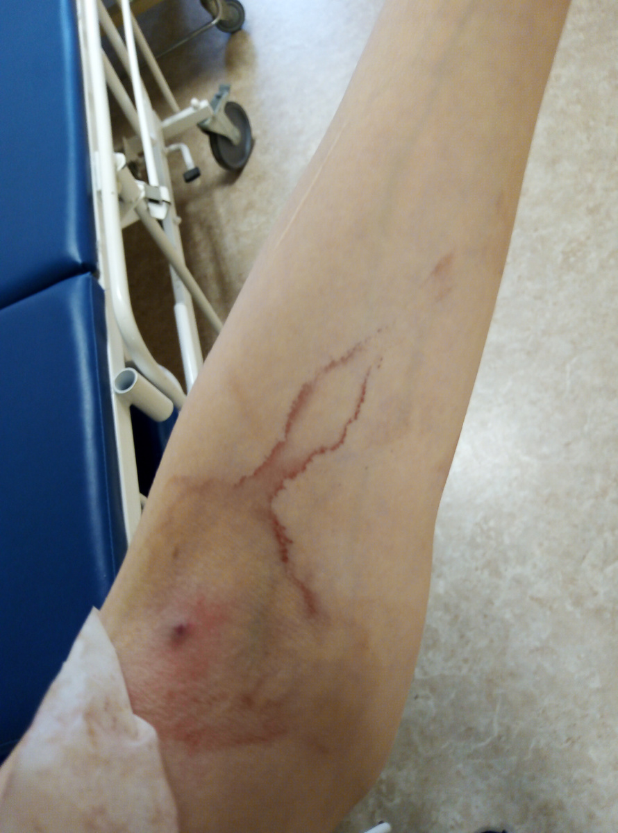 Взяли кровь из вены