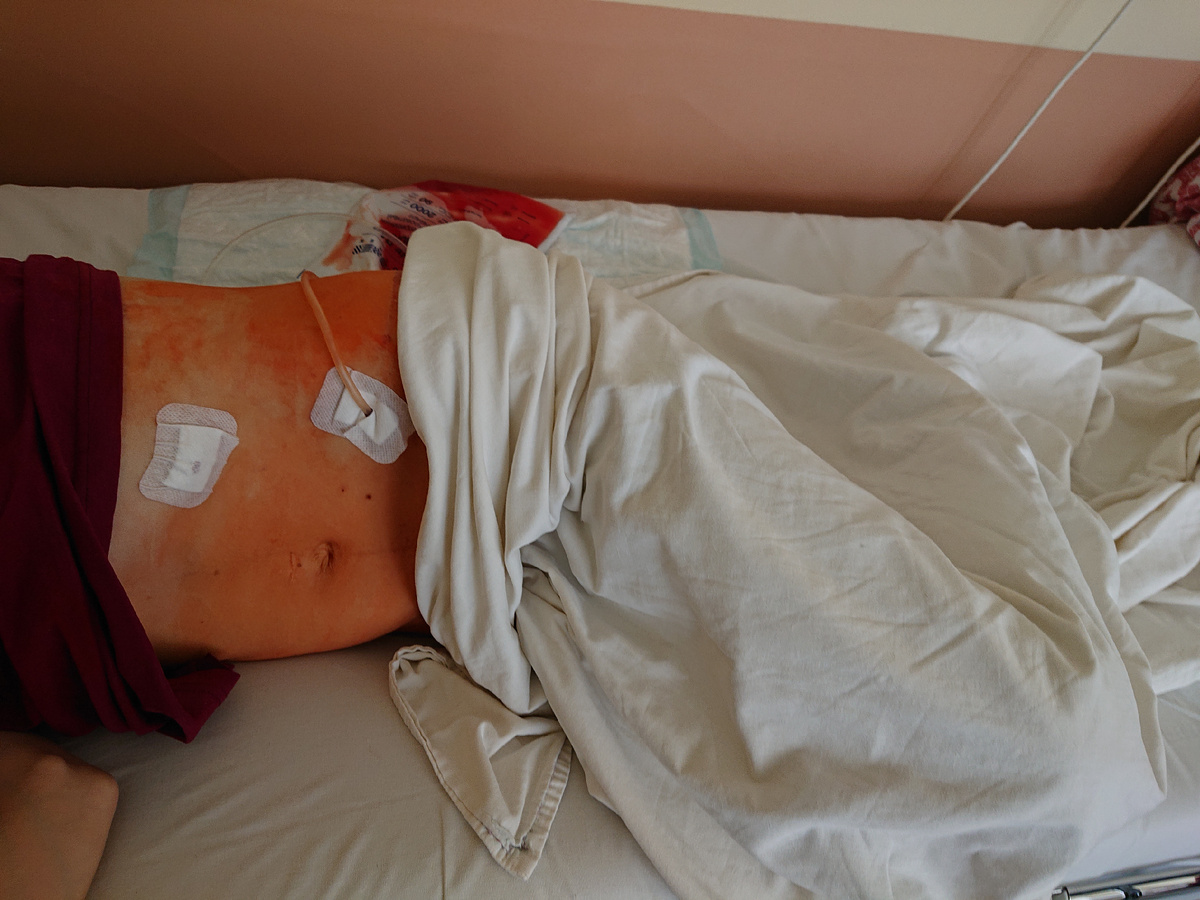  Через несколько часов после операции