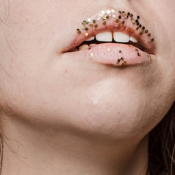 Герпес на самом деле крайне неприятная штука. Фото by supa.ru