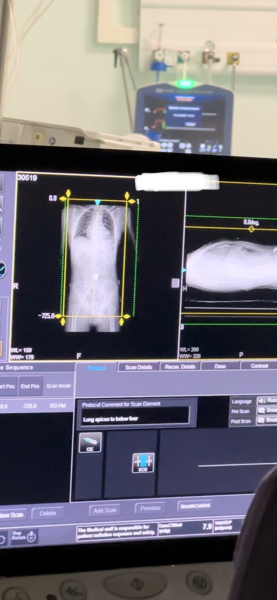 Начало КТ-исследования