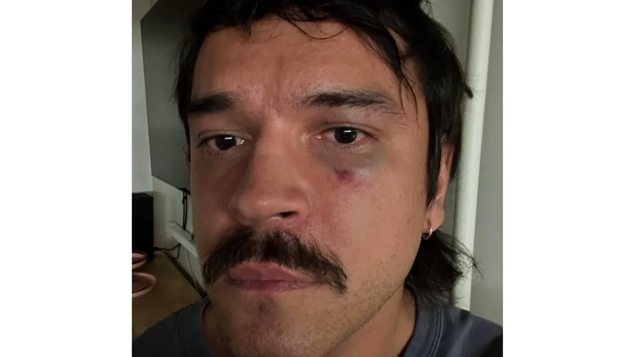    Фото: аккаунт в соцсетях Никиты Калмыкова