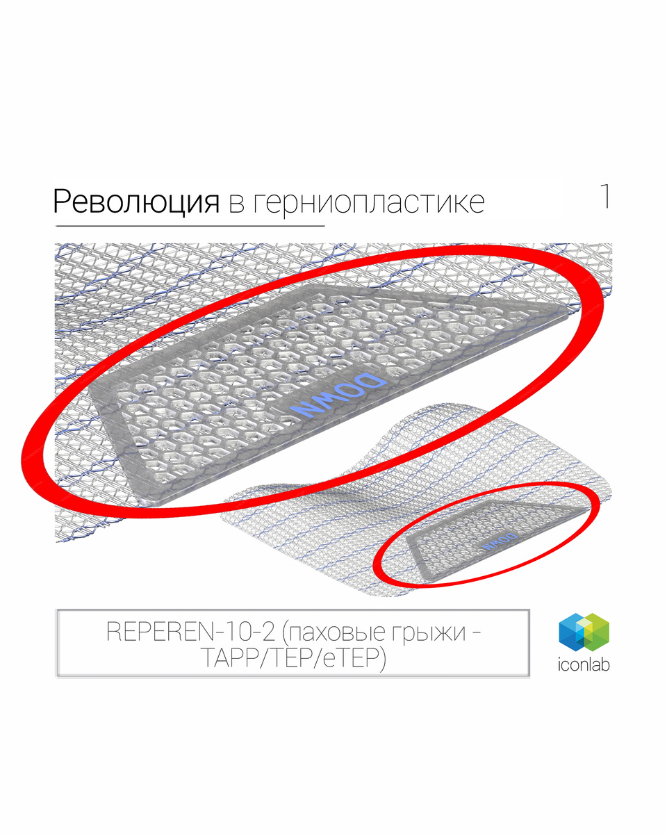 Российский эндопротез с целевой защитой критических структур инновационный эндопротез «REPEREN-10-2» для паховой герниопластики у мужчин.
