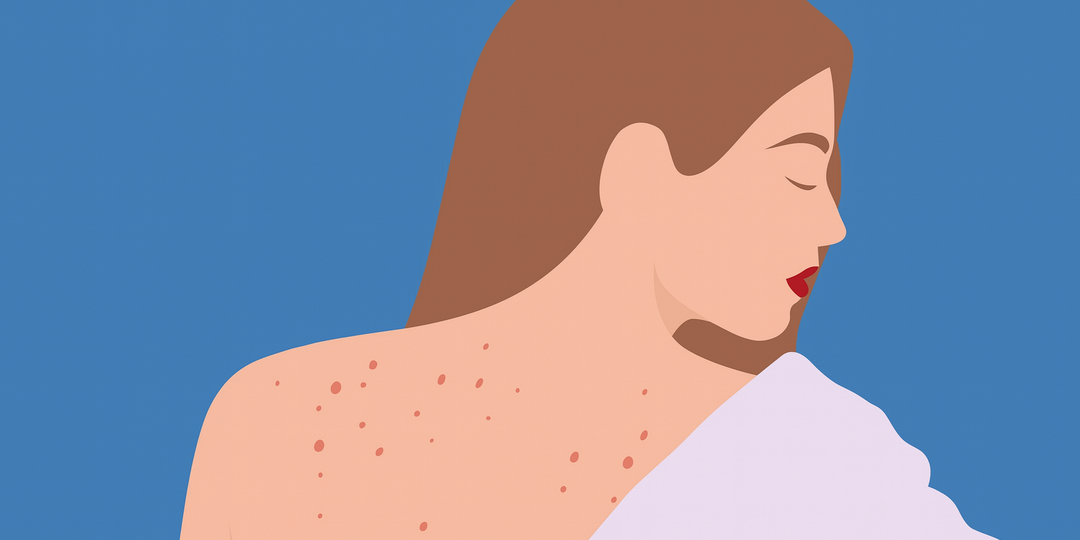 8 вопросов о псориазе