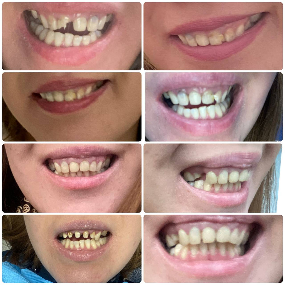 Мои зубы в разные годы жизни.