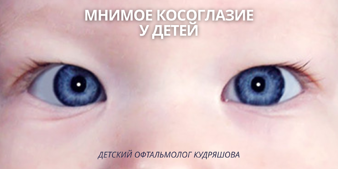Мнимое косоглазие у детей: что это и стоит ли волноваться