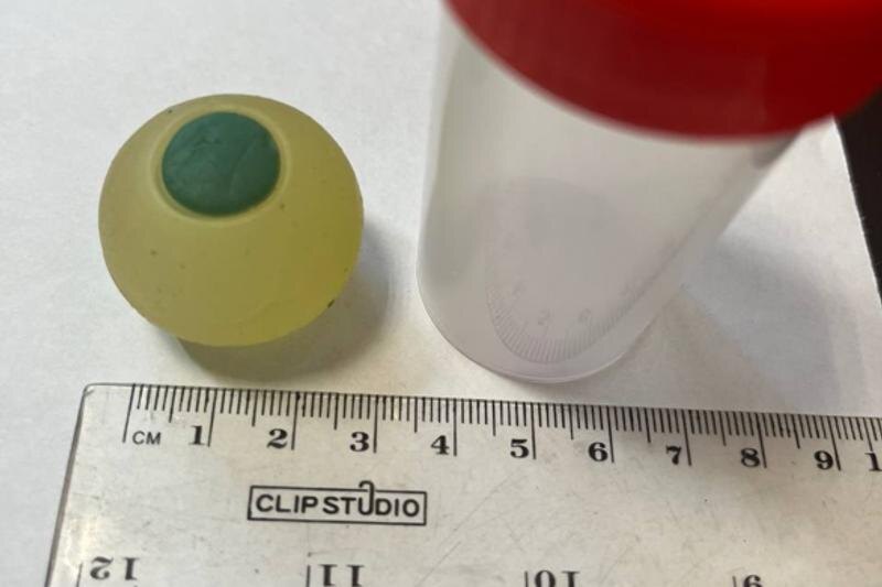    Минздрав. Силиконовый глаз