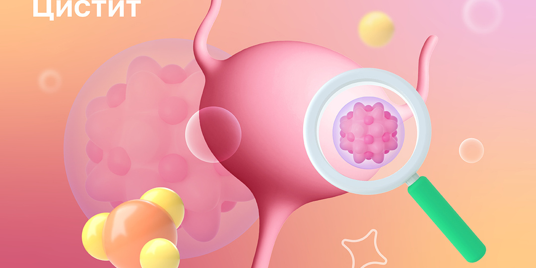 Цистит: деликатная проблема, требующая грамотного решения