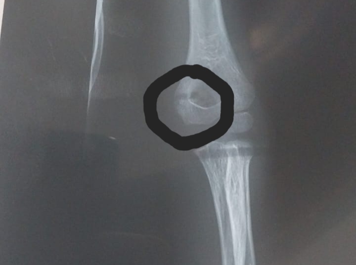 Вот эта широкая "трещина" оказалась совсем не трещиной