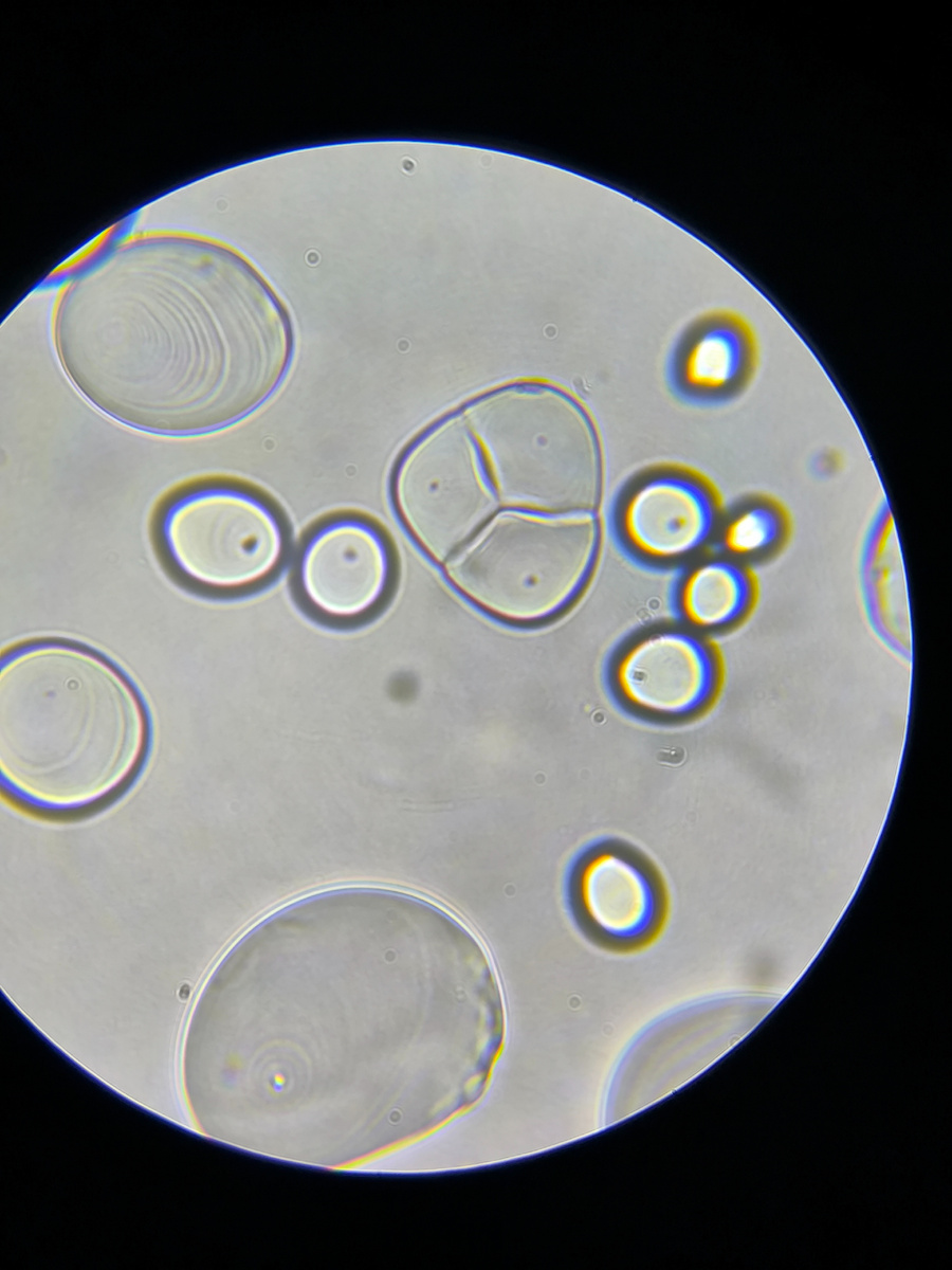 Ветом 1 под микроскопом