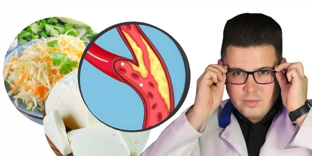 Как очистить сосуды от бляшек естественным способом: еда, которая работает