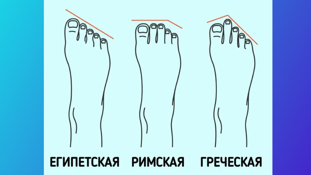 У меня Греческая стопа 