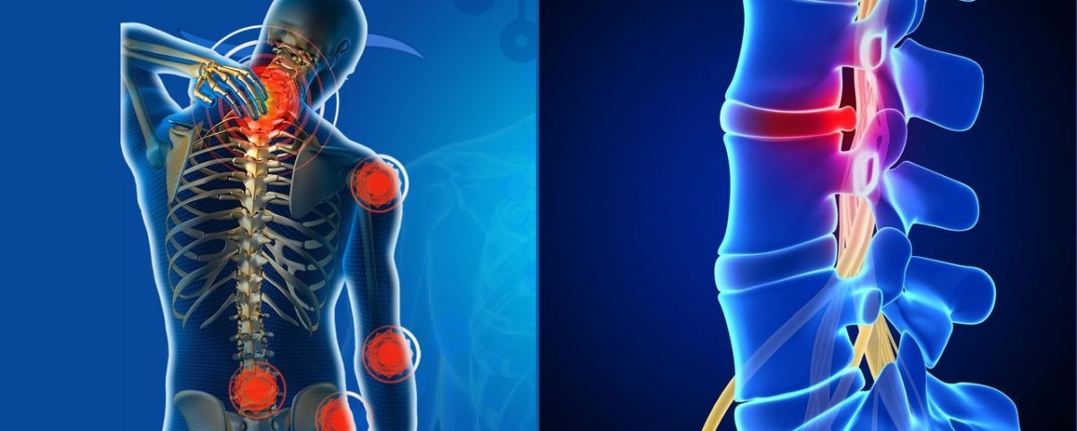 Радиочастотная абляция при болях в спине: современный метод без операции