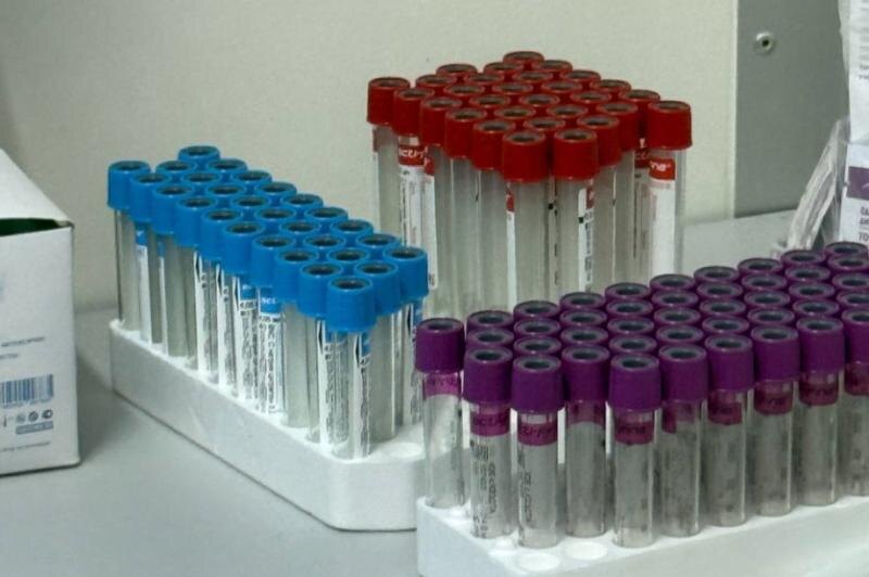 73 новых случая ВИЧ выявили на Камчатке за 9 месяцев