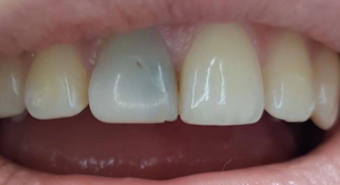 Думаете пройдёт само? 