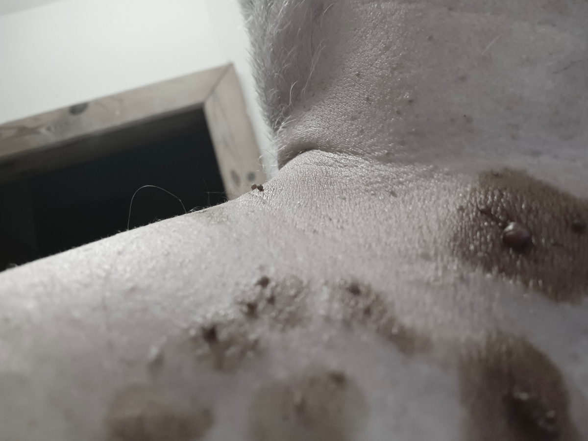 обработал йодом