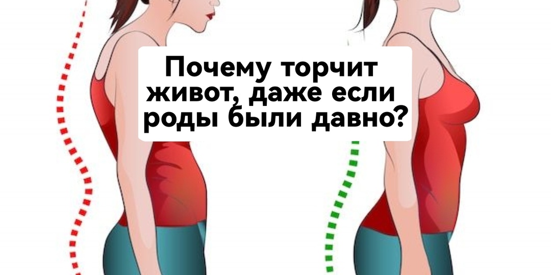 Почему торчит живот, даже если роды были давно?
