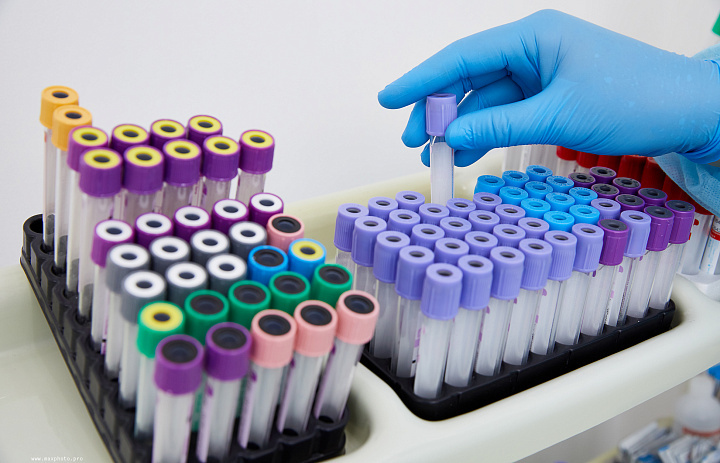 Повышены АСТ и АЛТ: о чём говорят эти цифры в анализах