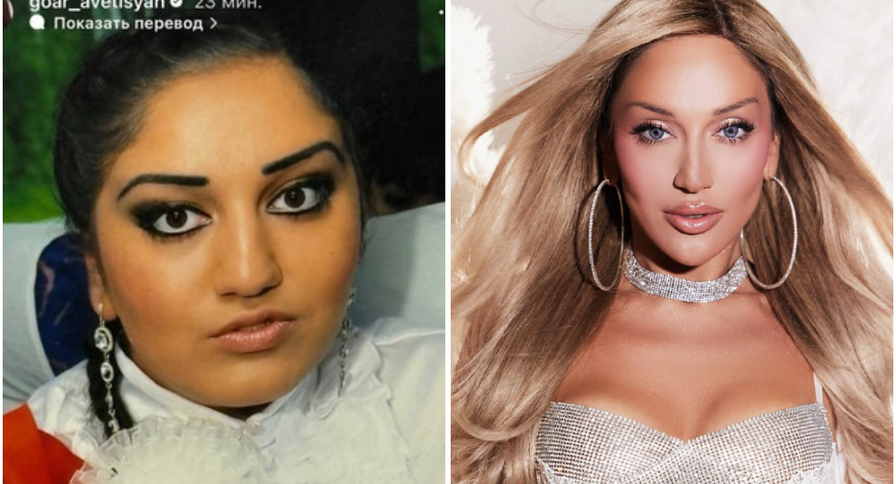 Будто совсем другие люди: как выглядели 8 знаменитостей в начале карьеры и как выглядят сейчас