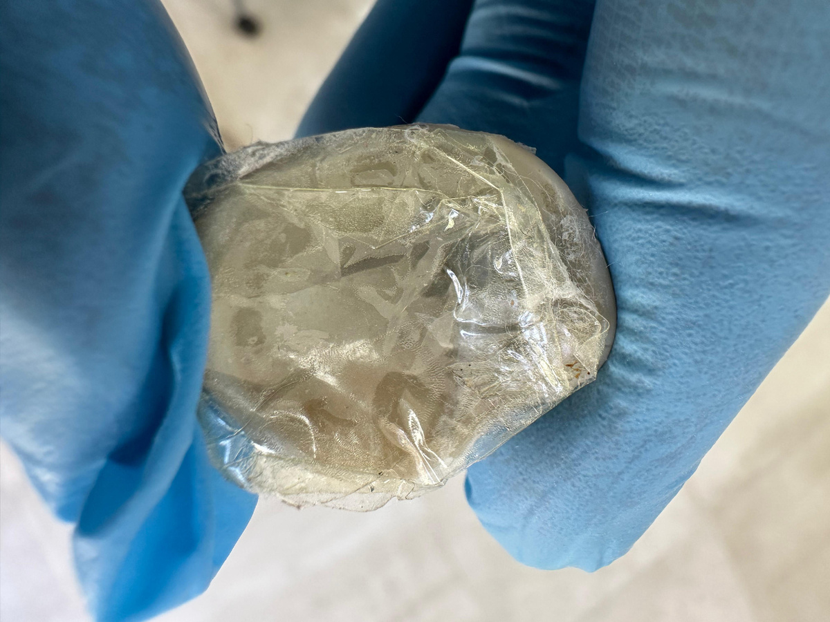 На фото — пример ремонта стеклянного глазного протеза, выполненного с помощью подручных средств.