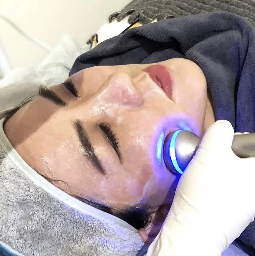 Лечение пациента с розацеа на аппарате LDM терапии