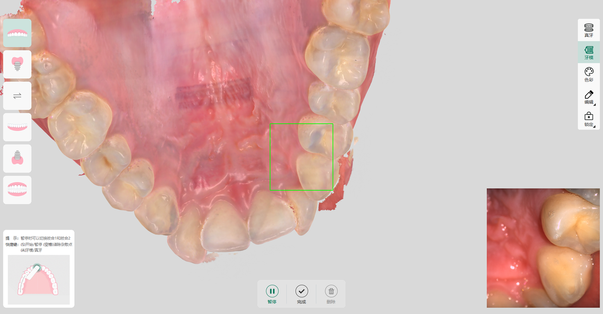 Интерфейс сканера Meyer mOS MyScan