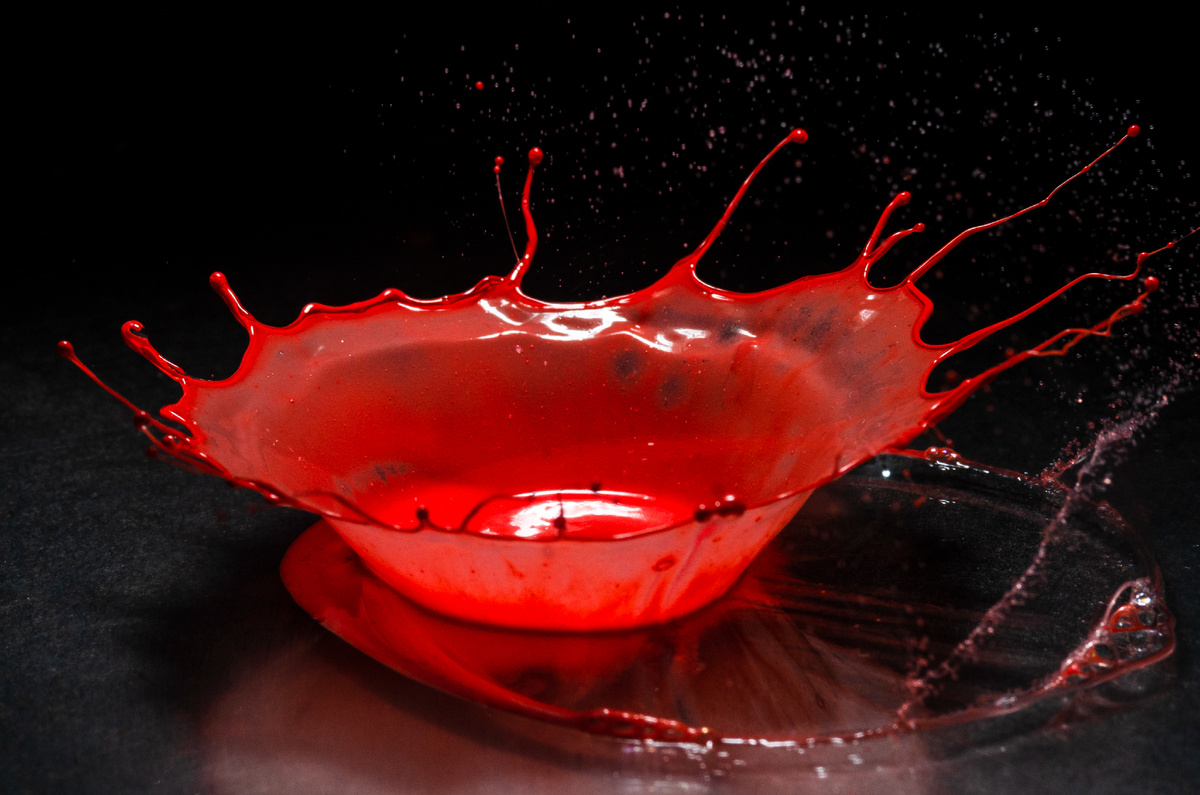 Откуда сгустки? Рассказывает гинеколог из W Clinic Мешкова Кристина