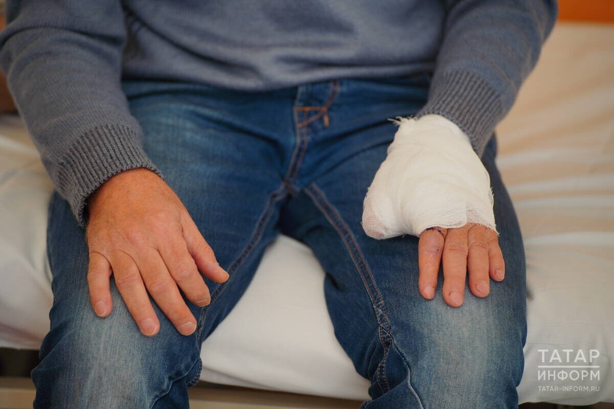 Рафис: «Окружающие обращают внимание и нередко ведут себя как дикари, увидев такой дефект. Проснувшись после наркоза в БСМП, я решил сразу, что буду восстанавливать утраченный палец»Фото: © Владимир Васильев / «Татар-информ»