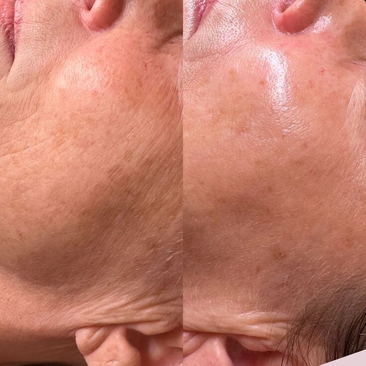 Работа ретинола.