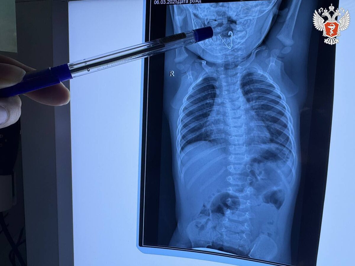 Источник фото - пресс-служба Министерства здравоохранения РФ