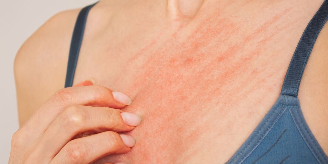 Когда зуд кожи связан не с аллергией, а с работой печени