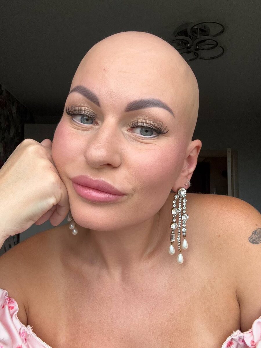 Та самая Настя, которую внезапно увидели все. Без парика, без фильтров, посреди детского сада. И знаете, мир не рухнул.