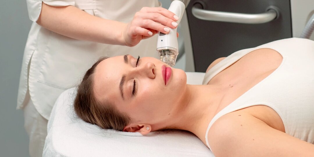 Омоложение лица при помощи процедуры RF-лифтинга