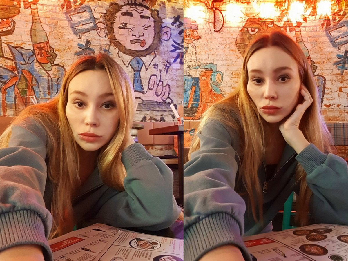 - зуб, + имплантат