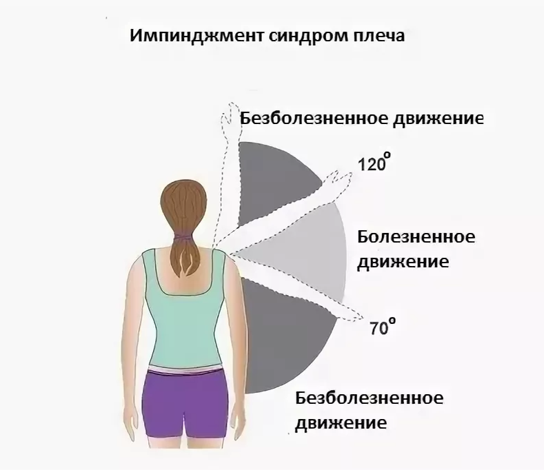 Боль увеличивается при подеме конечности.