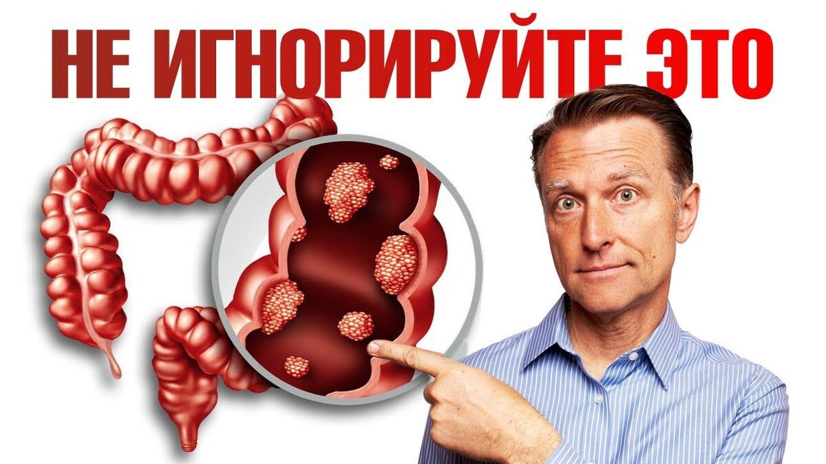 Почему рак кишечника часто начинается «в тишине» (Интервью с онкологом)