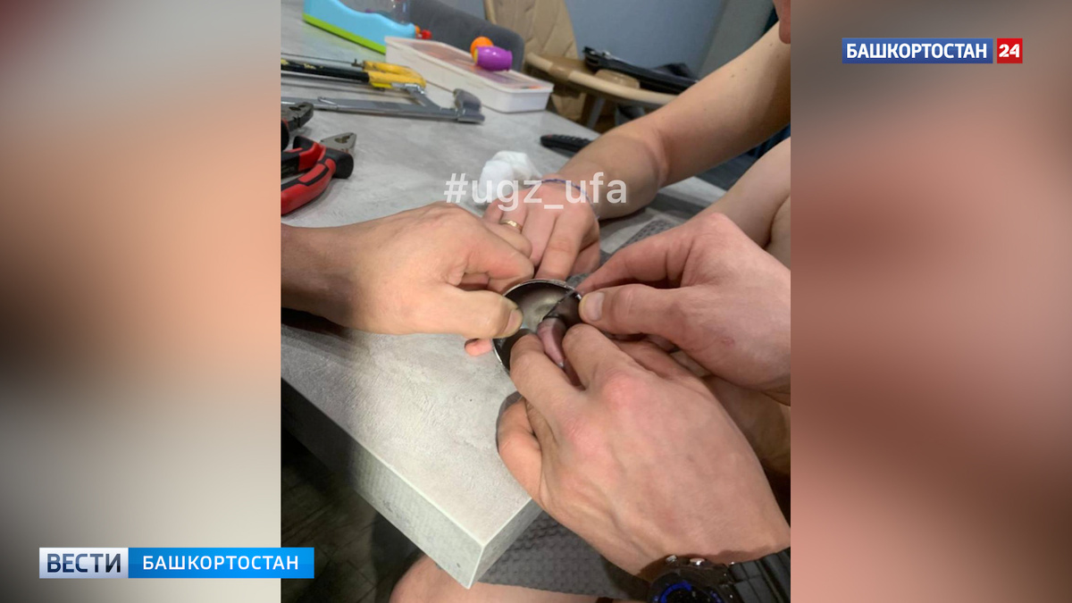    В Уфе спасатели освободили палец девочки, застрявший в металлическом звонке