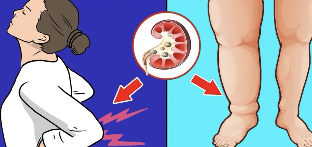 Диабетическая нефропатия: как контролировать повреждение почек по мнению врачей